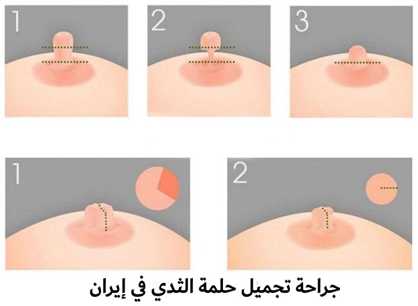 كيفية تكبير حلمة الثدي , سبب تقلص حجم الحلمه وعلاجه