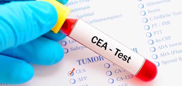 النسبة الطبيعية تحليل cea , تعرف حول cea