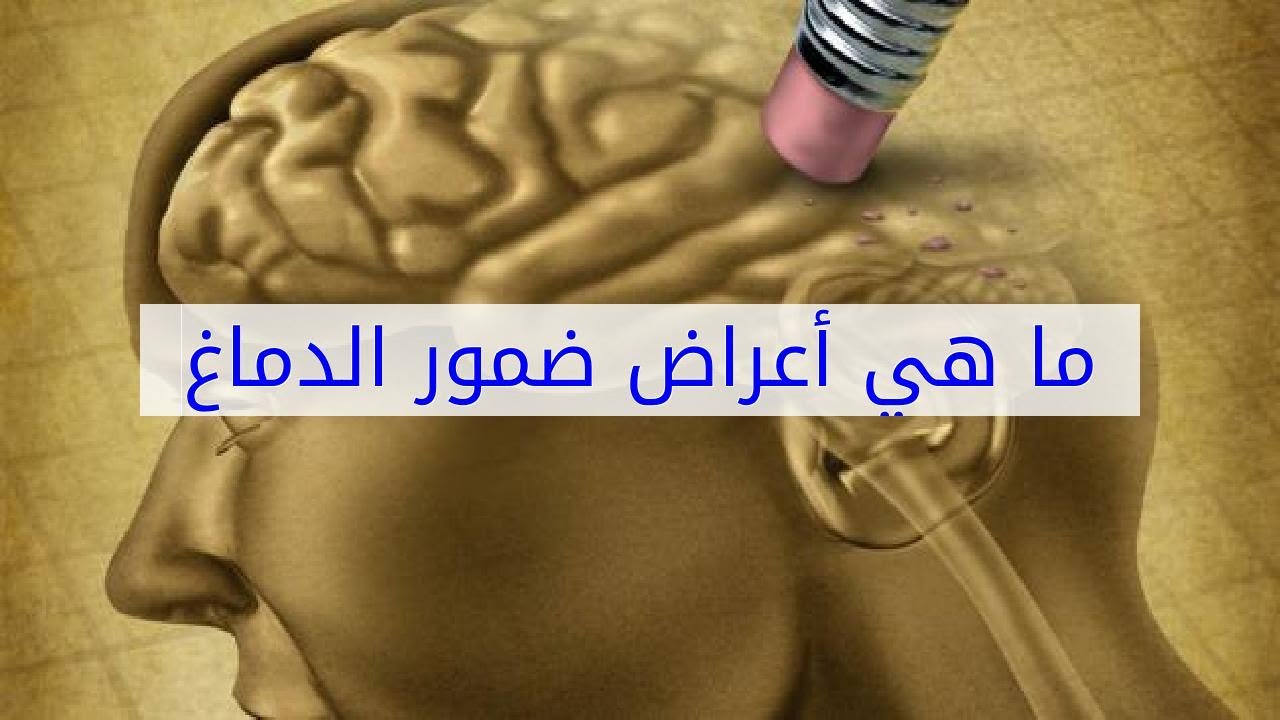 علاج ضمور المخ - طرق للوقايه والتخلص من اورام الدماغ 6079 1