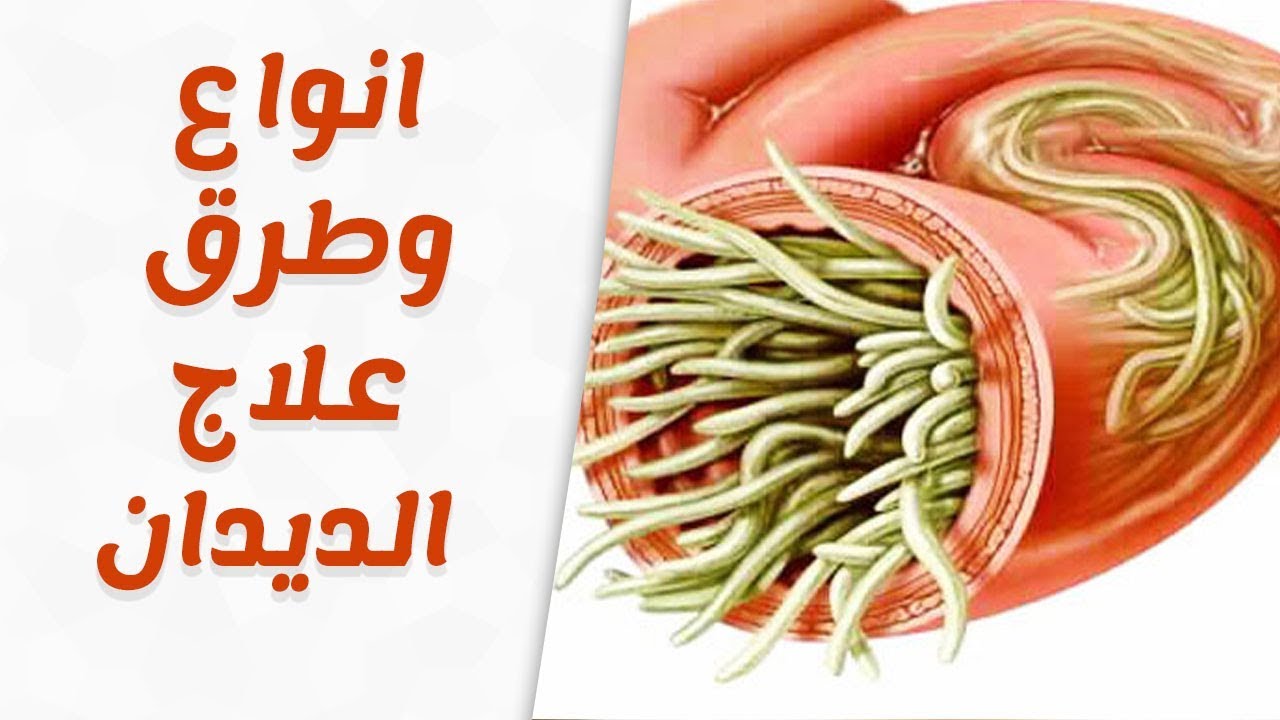 علاج الديدان عند الكبار , الديدان لها اضرار كثيره