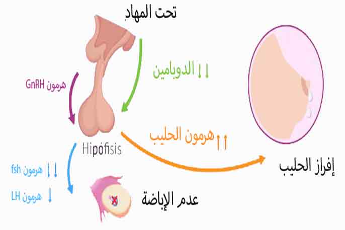 اسباب زيادة هرمون الحليب , معلومات عن فرط برولاكتين الدم