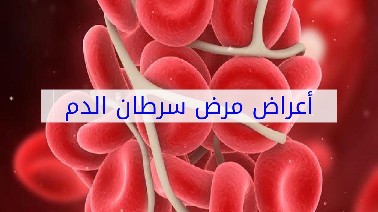 اعراض مرض سرطان الدم بالصور - من اخطر الامراض التى تواجه الانسان 5277 3