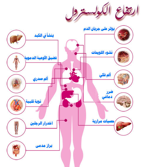 اسباب ارتفاع الكوليسترول،اعراض وعلاج ارتفاع الدهون الثلاثيه 5113 3