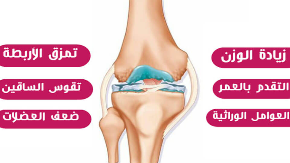 الام الركبة وعلاجها،نصائح للحفاظ علي سلامه الركبه 4673 2