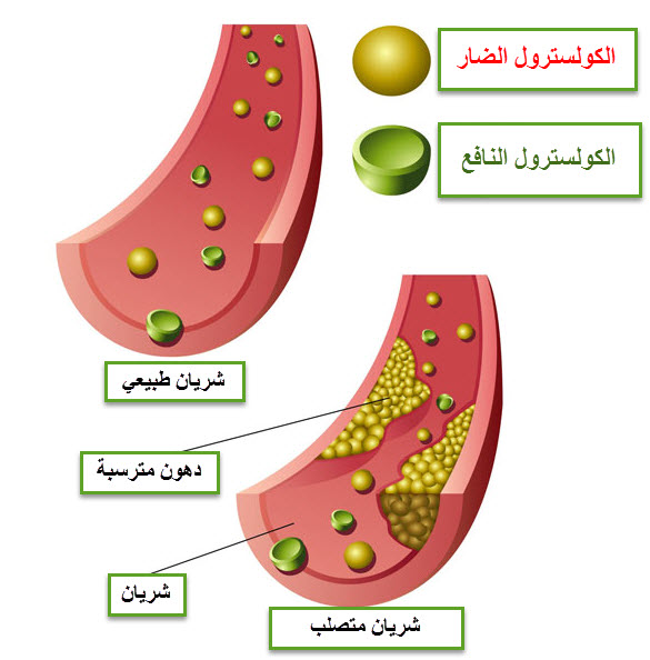 شيئ اذا زاد في الطعام سبب ضرر - حل لغز رقم 42