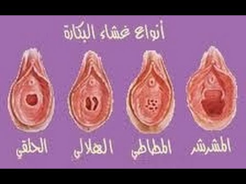 كيف تعرف البنت عذراء،طريقه بسيط وسهله لاكتشاف عزريه البنت 4751 3