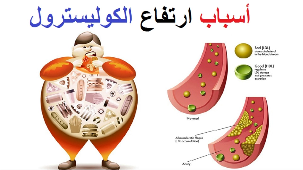 علاج للقضاء على الدهون الثلاثية والكولسترول وتخفيف الوزن - طرق لم تراها من قبل لوصفات للتخلص من الدهون وتخفيف الوزن بشكل تلاحظه 8125 2