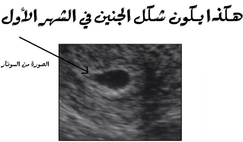 مراحل نمو الجنين بالصور السونار - لدينا خطوات مراحل نمو الجنين في فتره الحمل بالسونار 7853 1