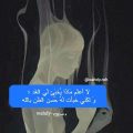 Unnamed File 6 الحزن الداخلي - عتمة القلب والالم هند وصاف