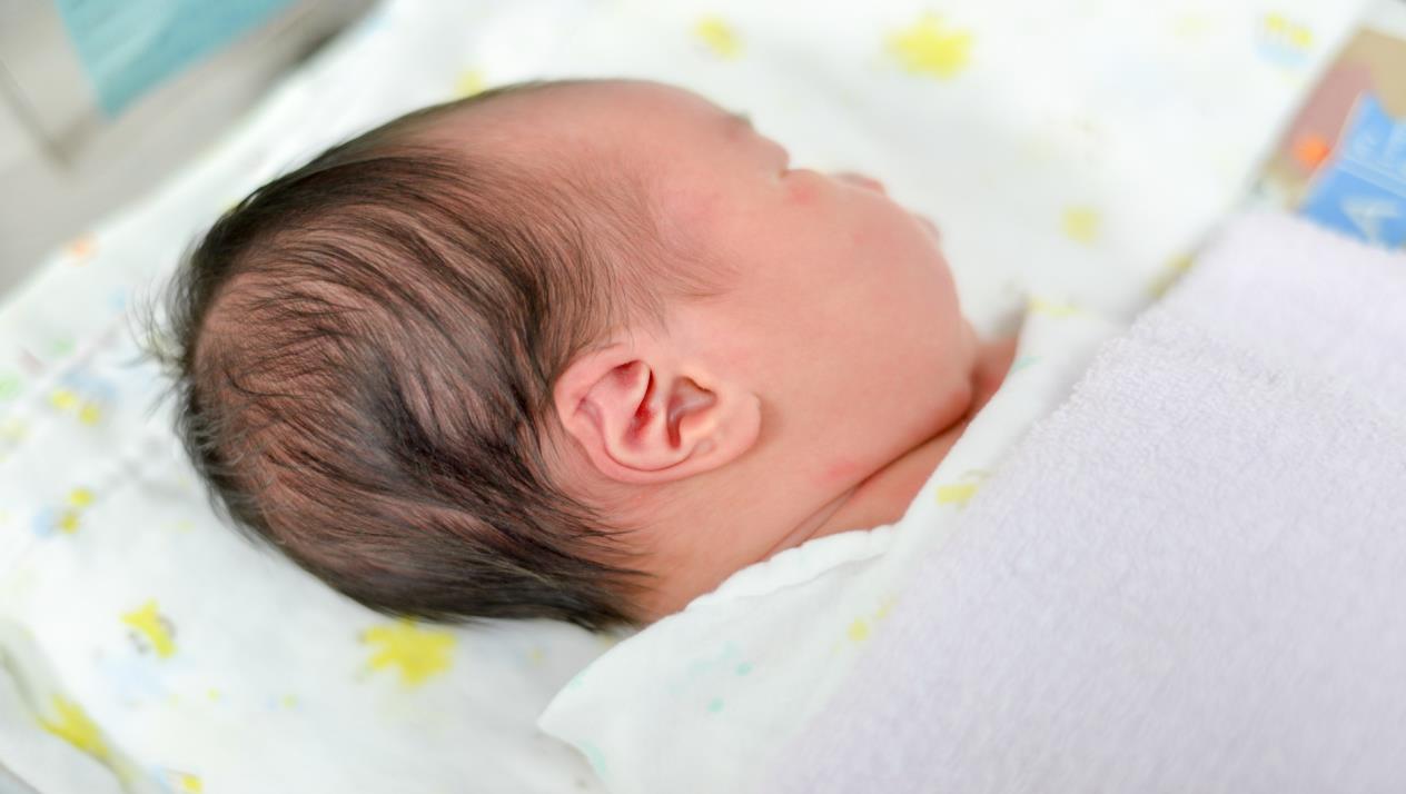 5827 1 حجم راس الطفل الطبيعي - علامات تظهرعلى الاطفال حديثى الولاده تليد خلف